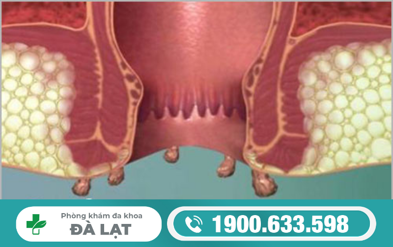 Hình ảnh minh họa